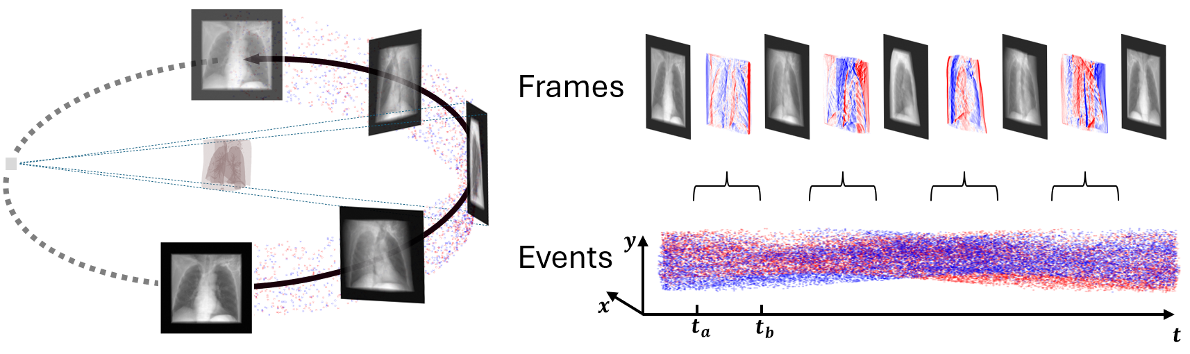 Neuromorphic X-ray CT acquisition with sparse frames and asynchronous events