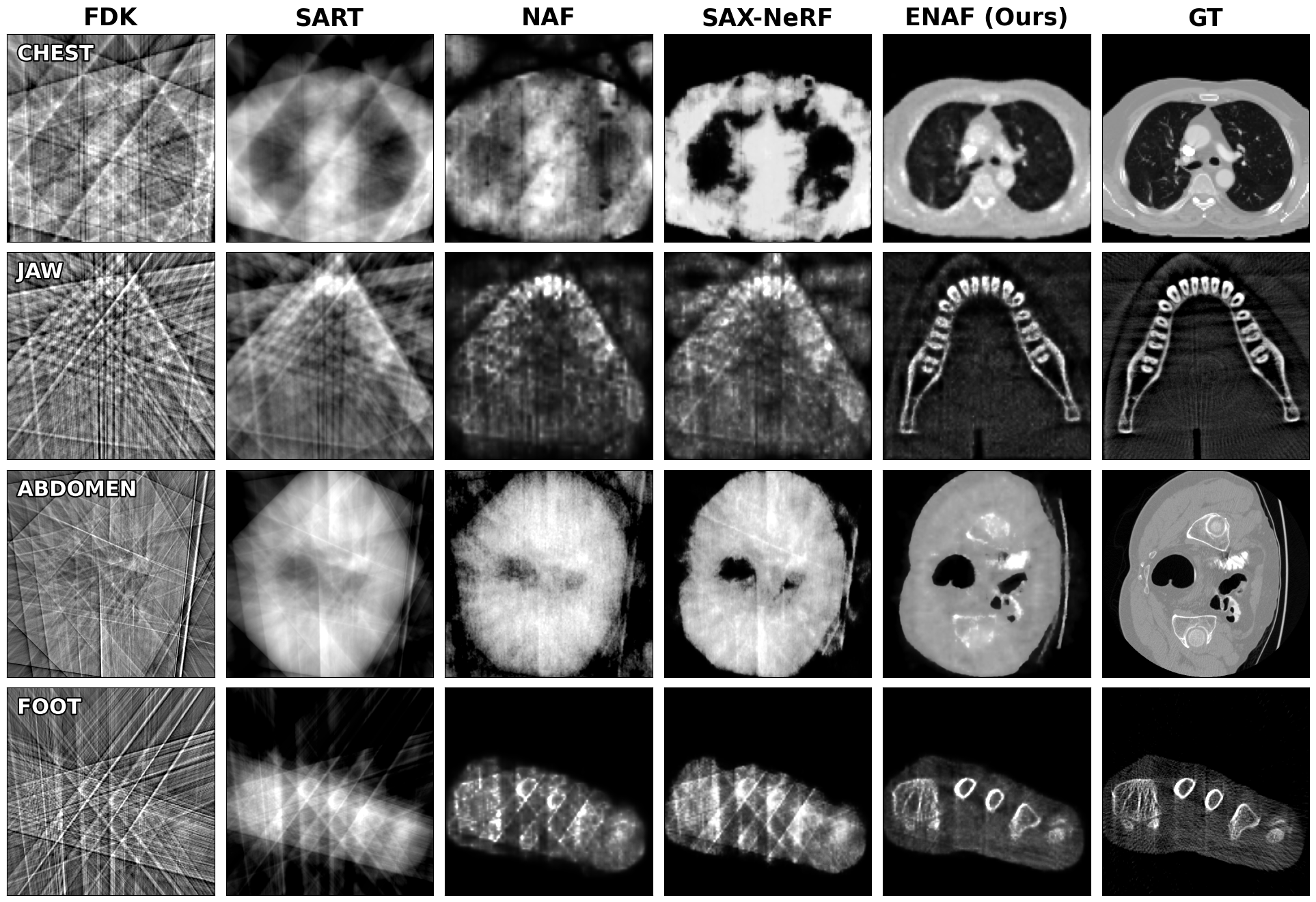 Qualitative comparison of 5-view sparse-view CT reconstruction
