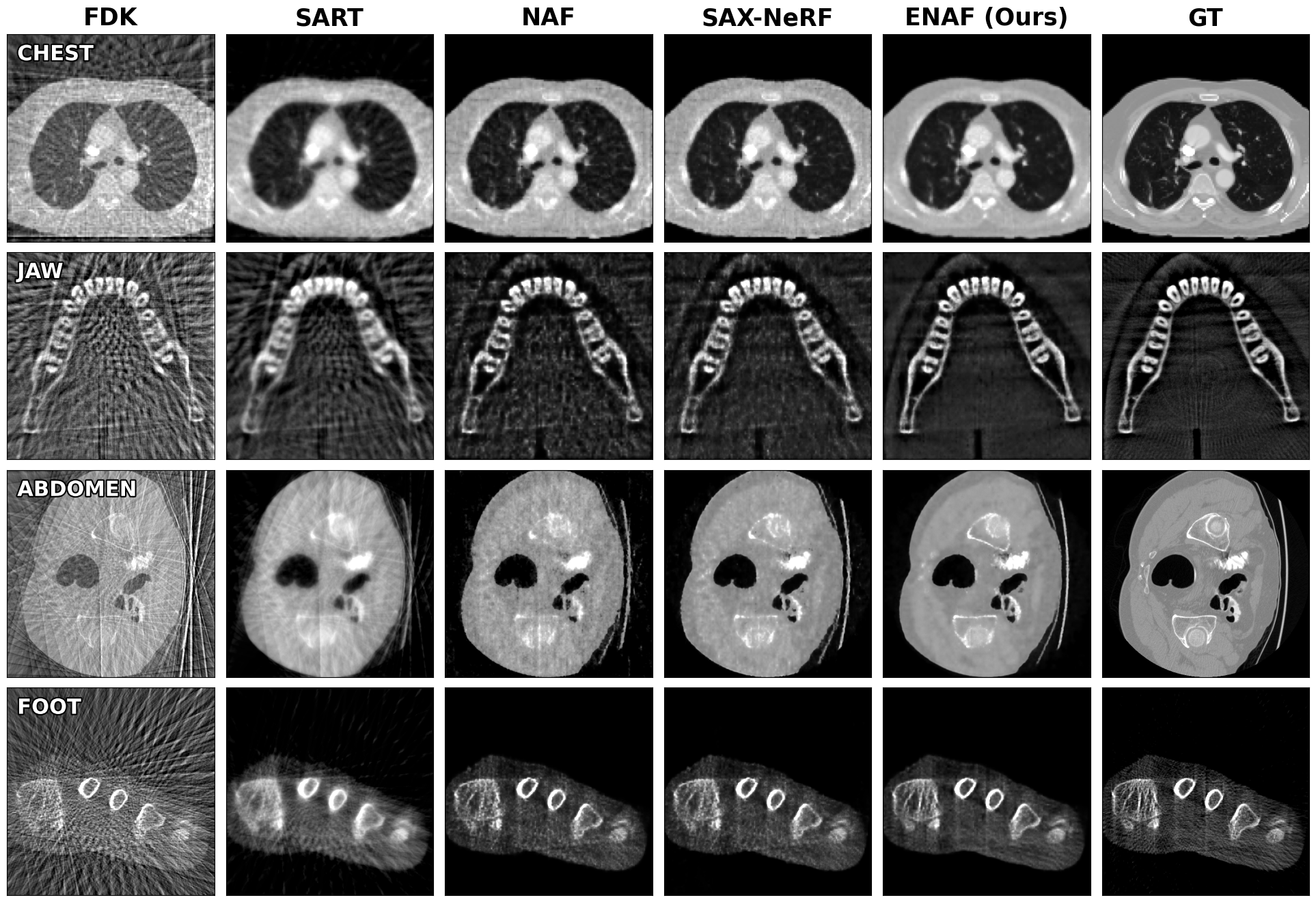 Qualitative comparison of 25-view sparse-view CT reconstruction